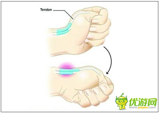 玩手機易患十大“智能手機病” 這些癥狀你都有嗎？